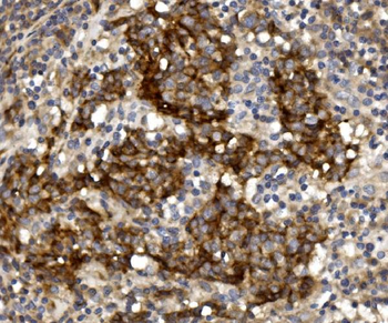 Claudin 1/CLDN1 Antibody
