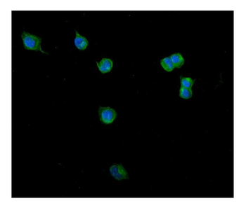 Clathrin heavy chain/CLTC Rabbit Polyclonal Antibody