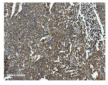 Clathrin heavy chain/CLTC Rabbit Polyclonal Antibody