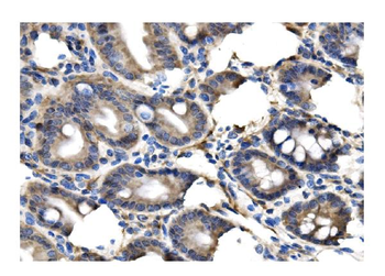 Clathrin heavy chain/CLTC Rabbit Polyclonal Antibody