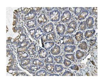 Clathrin heavy chain/CLTC Rabbit Polyclonal Antibody