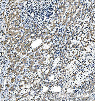 CYP7A1 Rabbit Polyclonal Antibody