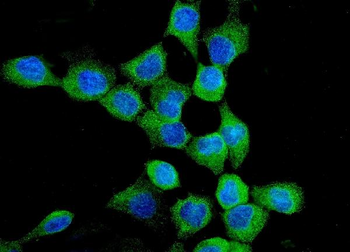 EGFR Rabbit Polyclonal Antibody