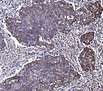 EGFR Rabbit Polyclonal Antibody