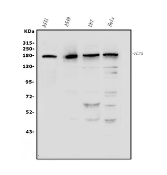 EGFR Rabbit Polyclonal Antibody
