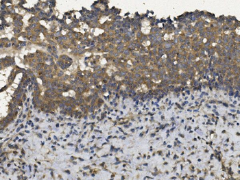 EIF2AK4 Rabbit Polyclonal Antibody