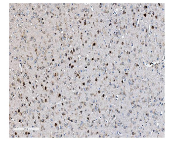 EIF2B1 Antibody