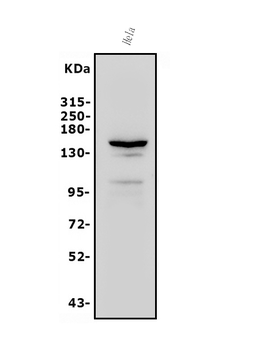 FLT1 Rabbit Polyclonal Antibody