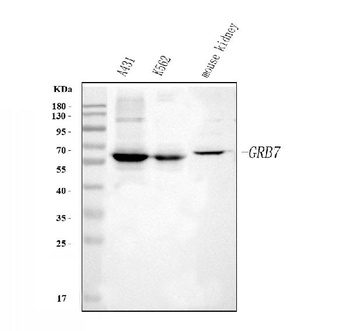 GRB7 Rabbit Polyclonal Antibody