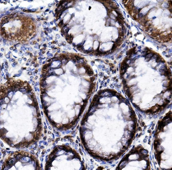 HIF-1 alpha/HIF1A/HIF Rabbit Polyclonal Antibody