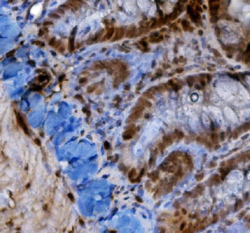 HIF-1 alpha/HIF1A/HIF Rabbit Polyclonal Antibody