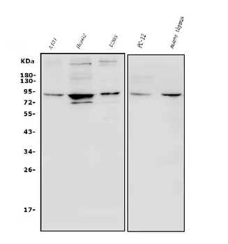 HIF-1 alpha/HIF1A/HIF Rabbit Polyclonal Antibody