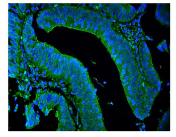 LPP Rabbit Polyclonal Antibody