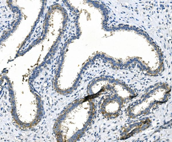 LPP Rabbit Polyclonal Antibody