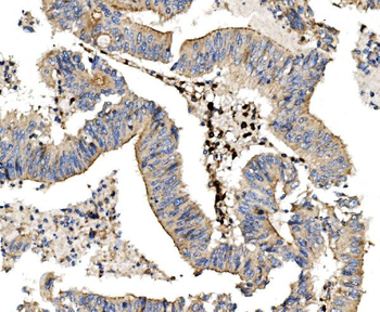 LPP Rabbit Polyclonal Antibody