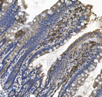 LPP Rabbit Polyclonal Antibody
