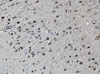 MEK2/MAP2K2 Rabbit Polyclonal Antibody