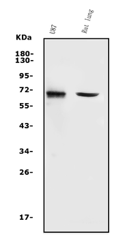 MMP2 Rabbit Polyclonal Antibody