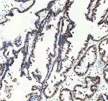 MSH6 Antibody