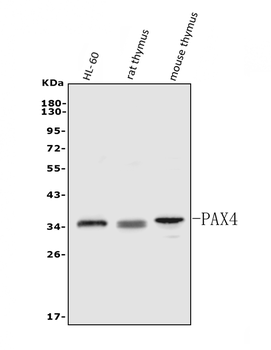 PAX4 Rabbit Polyclonal Antibody