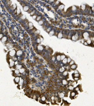 REA/PHB2 Rabbit Polyclonal Antibody