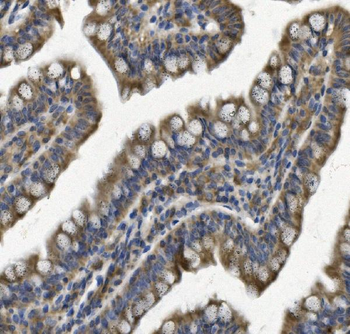 REA/PHB2 Rabbit Polyclonal Antibody
