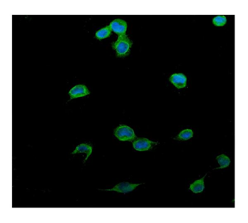 PTCH2 Rabbit Polyclonal Antibody