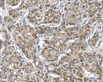 PTCH2 Rabbit Polyclonal Antibody