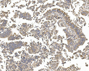 PTCH2 Rabbit Polyclonal Antibody