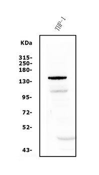 PTCH2 Rabbit Polyclonal Antibody