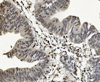 SAMHD1 Rabbit Polyclonal Antibody