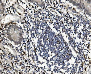 SAMHD1 Rabbit Polyclonal Antibody