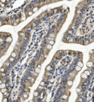 SAMHD1 Rabbit Polyclonal Antibody