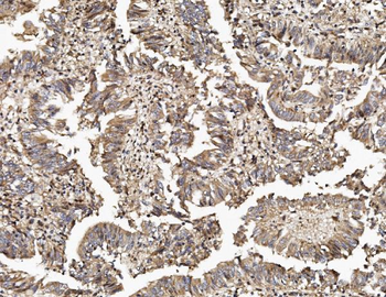 TAB2 Rabbit Polyclonal Antibody