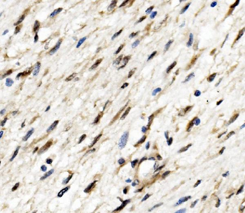ETF/TEAD2 Rabbit Polyclonal Antibody