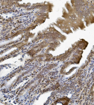 ETF/TEAD2 Rabbit Polyclonal Antibody