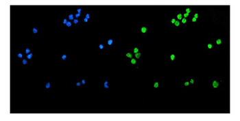 TET1 Rabbit Polyclonal Antibody