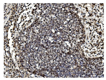 TET1 Rabbit Polyclonal Antibody