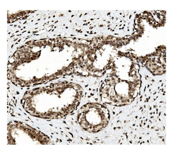 TET1 Rabbit Polyclonal Antibody