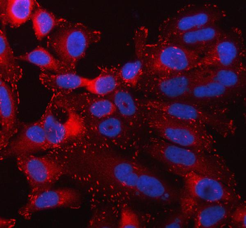 Talin 1/TLN1 Rabbit Polyclonal Antibody