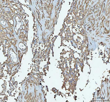 Talin 1/TLN1 Rabbit Polyclonal Antibody
