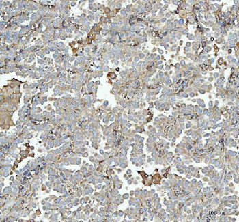 Talin 1/TLN1 Rabbit Polyclonal Antibody