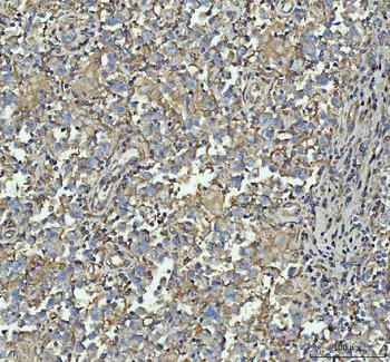 Talin 1/TLN1 Rabbit Polyclonal Antibody