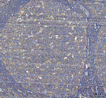 Talin 1/TLN1 Rabbit Polyclonal Antibody