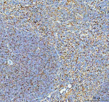 Talin 1/TLN1 Rabbit Polyclonal Antibody