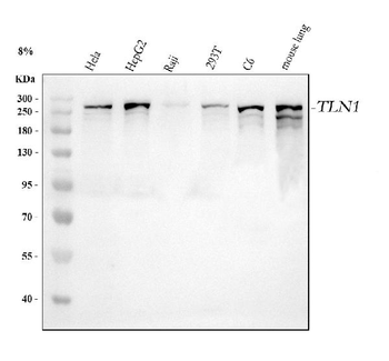 Talin 1/TLN1 Rabbit Polyclonal Antibody