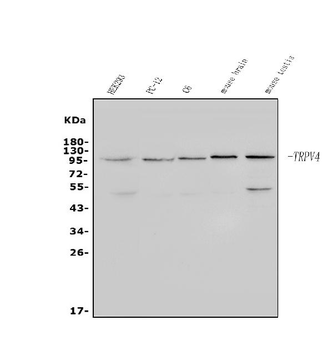 TRPV4 Rabbit Polyclonal Antibody