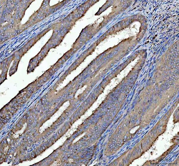 Tubulin alpha Rabbit Polyclonal Antibody