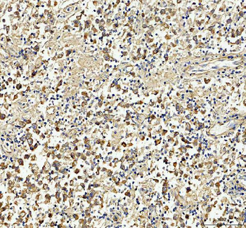 Tubulin beta Rabbit Polyclonal Antibody