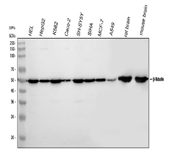 Tubulin beta Rabbit Polyclonal Antibody